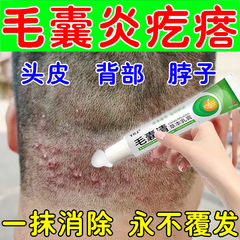 毛囊炎痘痘疙瘩止痒消肿抑菌乳膏