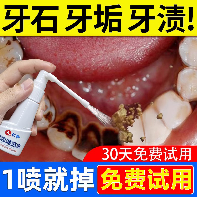 牙结石去除器溶解除牙石非速效漱口水洗牙齿污垢牙黄牙垢清除神器