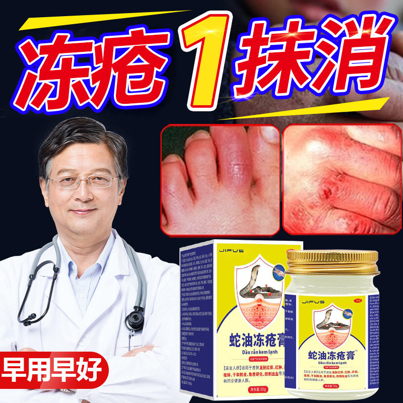 冻疮膏止痒冻伤膏正品肝素钠乳膏防冻疮防裂防儿童手足耳朵冻伤药