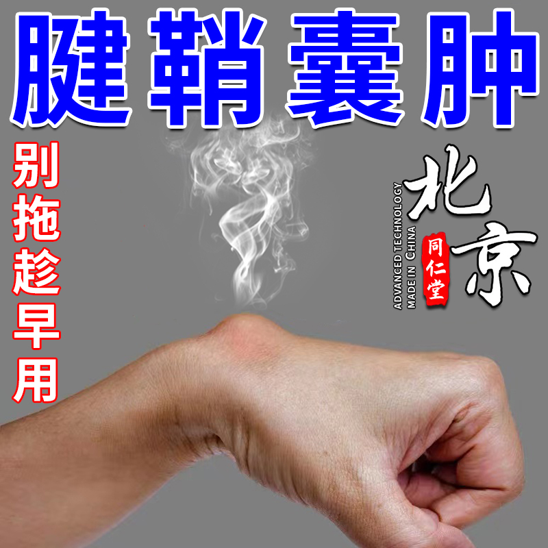 北京同仁堂腱鞘囊肿贴鼓包专治疗脚背大拇指腱鞘炎专用的膏药正品