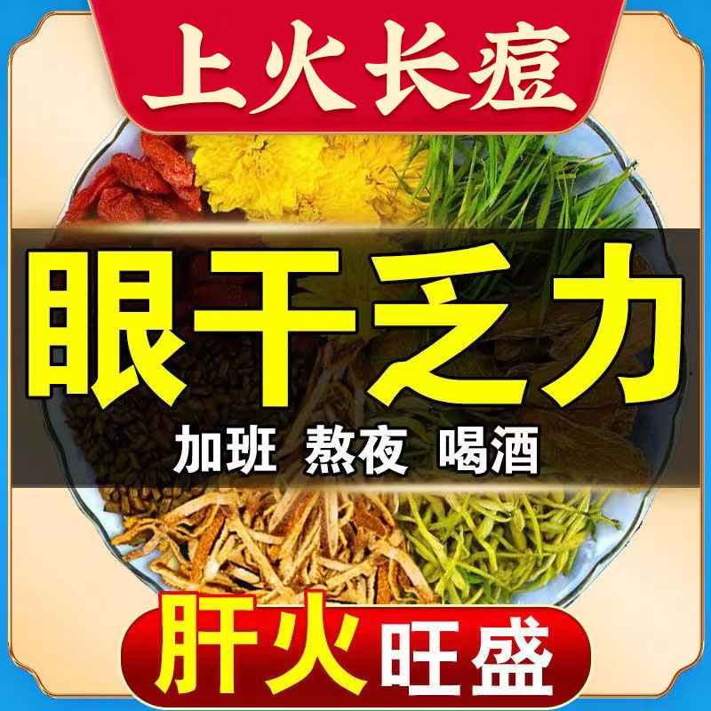 上火长痘菊花决明子枸杞牛蒡根下火清火茶叶花茶眼干乏力加班男女