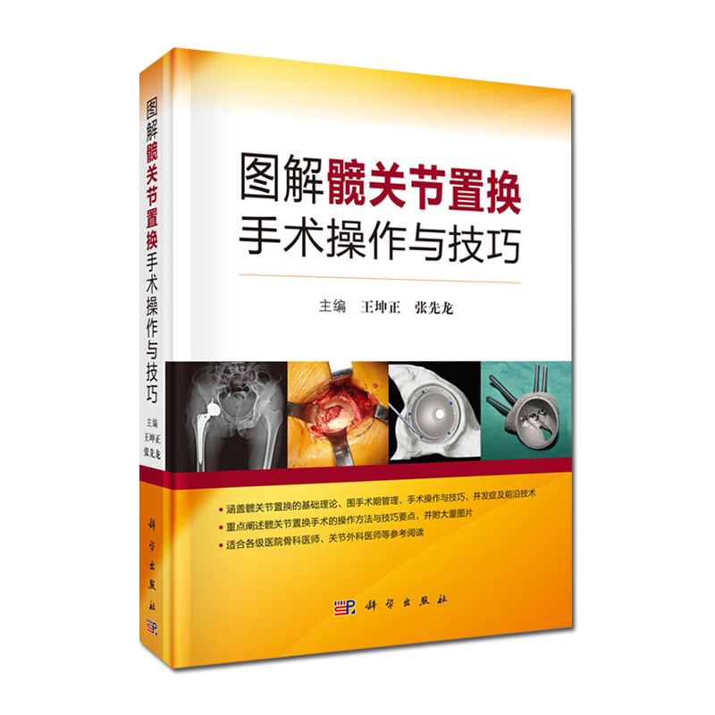 图解髋关节置换手术操作与技巧 王坤正 张先龙主编 髋关节基础理论手术技巧 临床医学 科学出版社 9787030656667
