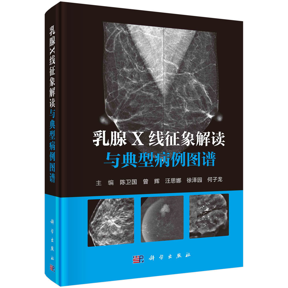 乳腺X线征象解读与典型病例图谱 陈卫国 曾辉 汪思娜 徐泽园 何子龙 乳腺X线MG乳腺癌筛查诊断乳腺疾病影像检查X线征象鉴别诊断
