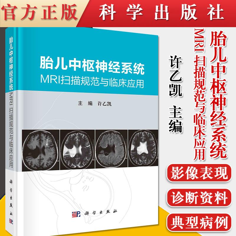 胎儿中枢神经系统MRI扫描规范与临床应用 科学出版社9787030684813