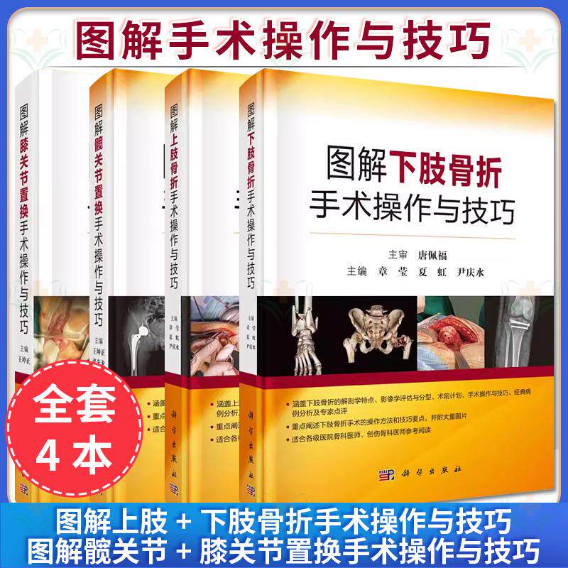 正版4本 图解上肢下肢骨折手术操作与技巧+图解髋关节置换手术操作与技巧+图解膝关节置换手术操作与技巧