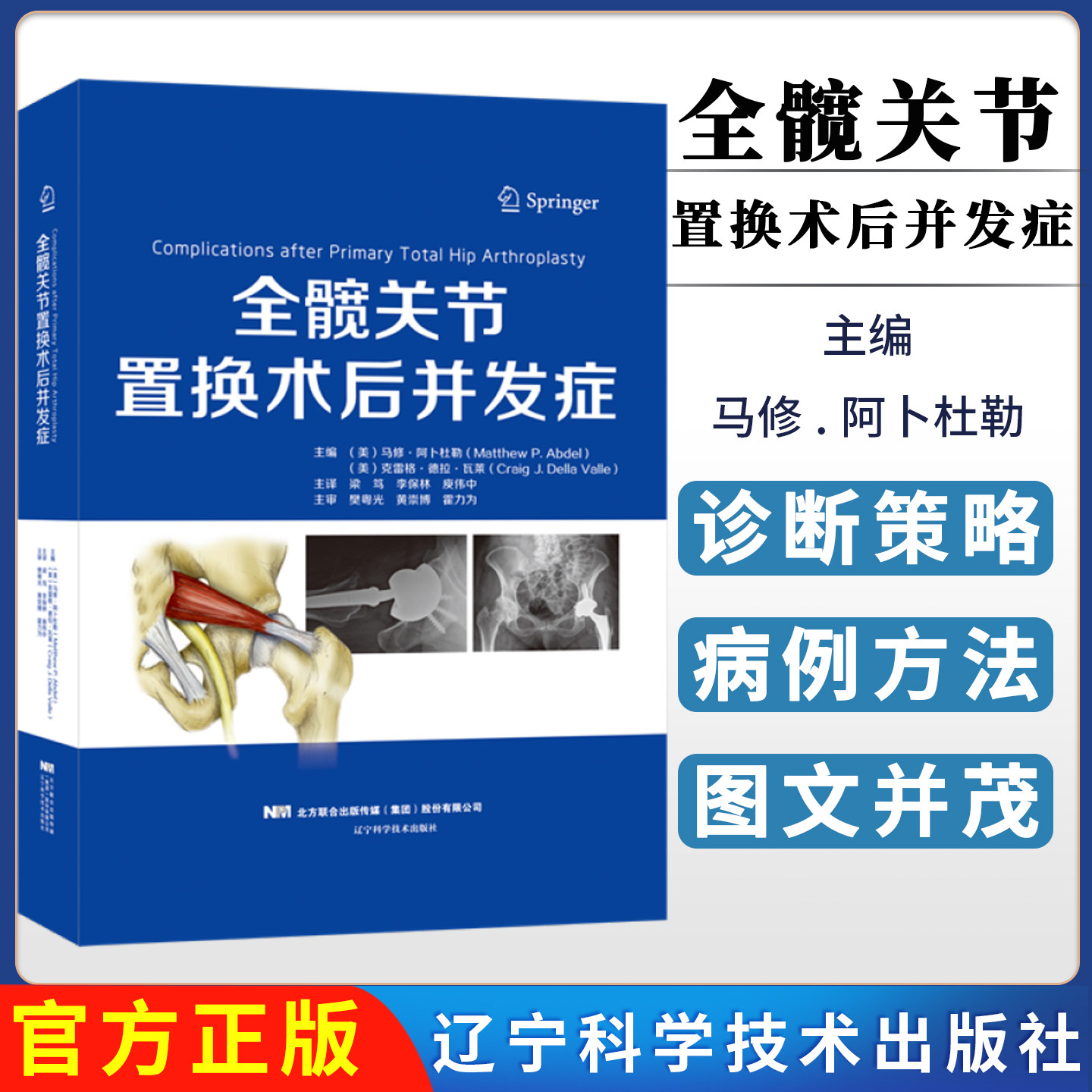 全髋关节置换术后并发症 辽宁科学技术出版社