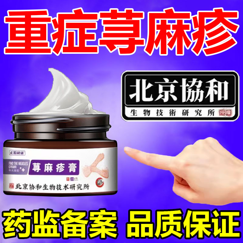 北京协和【200%垠除】荨寻麻疹