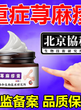 荨寻麻疹过敏止治痒皮肤痒膏提高人工胆碱性丘疹寒冷性儿童外用膏