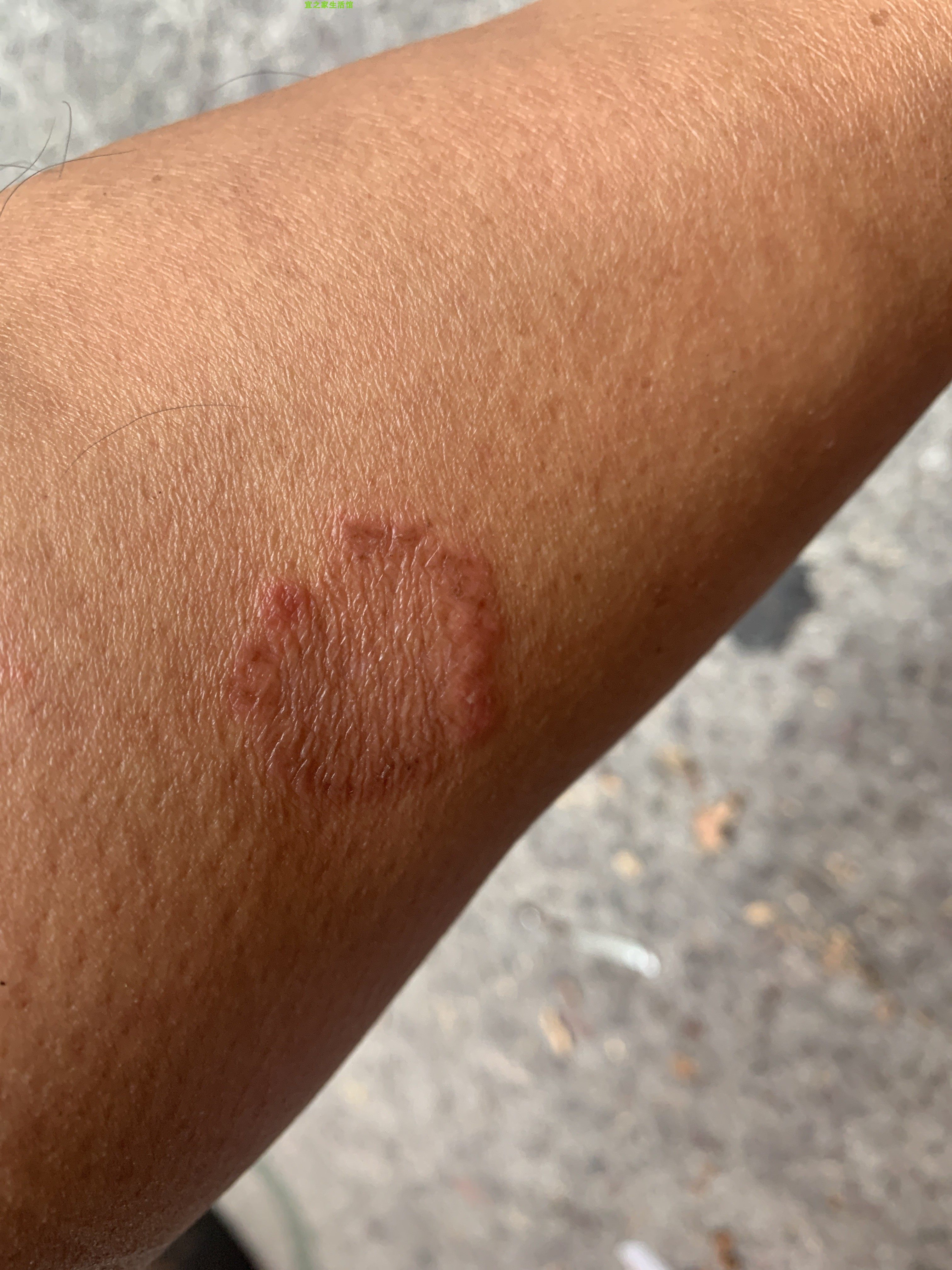 大腿红点牛皮癣天下康千草王药膏千草王皮肤草本药膏软膏止痒膏