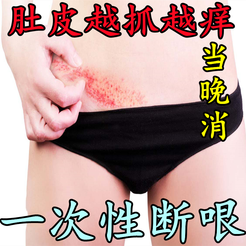肚子肚皮痒湿疹皮炎皮肤痒真菌感染纯植物无激素特效止痒外用药膏