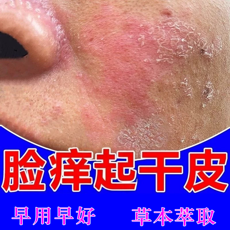 脸上发痒起干皮脸部皮肤干燥粗糙皮肤消毒护理（消）