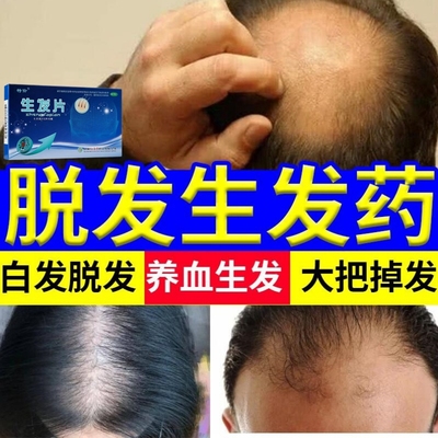 生发片掉发严重吃什么脂溢性脱发除脂生发片滋补生发非同仁堂特效