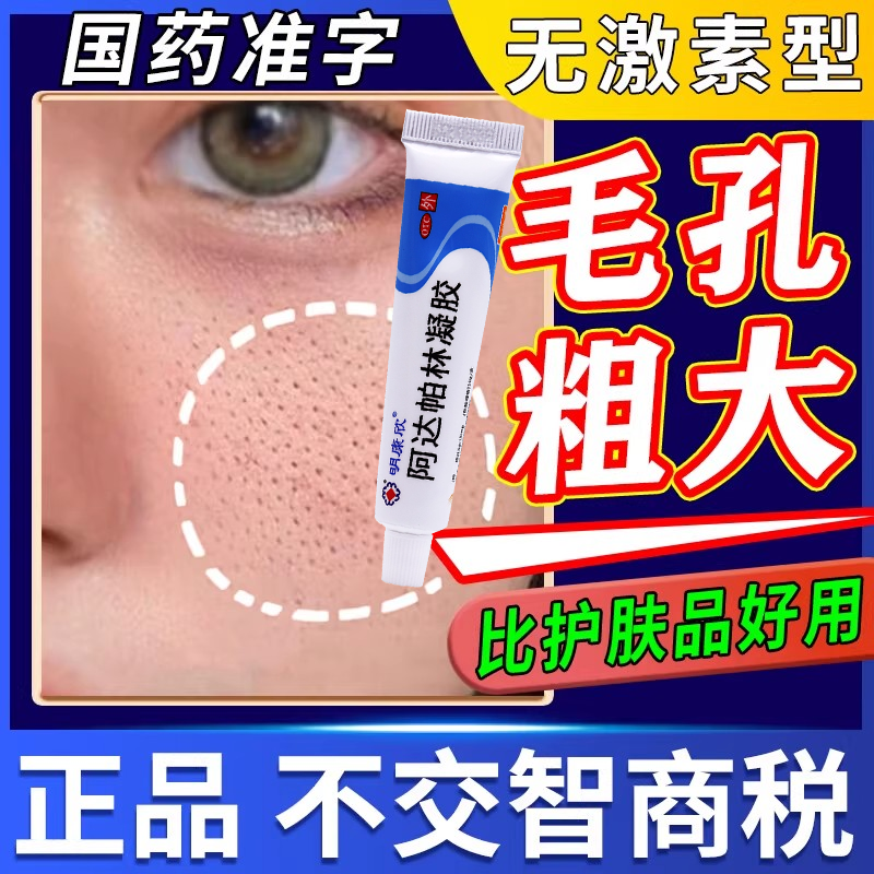 【明康欣】阿达帕林凝胶0.1%*10g*1支/盒痤疮粉刺丘疹祛痘去黑头