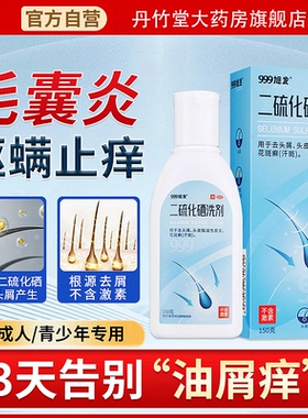 999二硫化硒洗剂洗发水去屑控油止痒去头皮屑毛囊炎水脂溢性皮炎