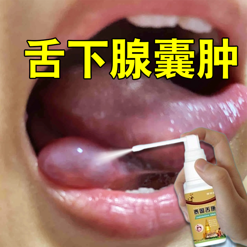 舌下腺囊肿滤泡疙瘩嘴巴下长包导管阻塞舌根有硬块口腔疼痛特效s