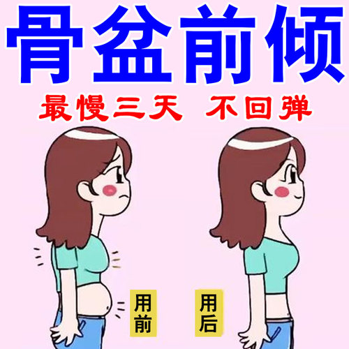 骨盆前倾矫正器盆骨小腹突出腰疼痛假胯宽修复XO型腿盆肌收胯专用