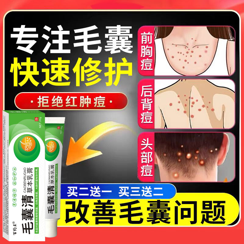 毛囊焱专用膏头部脖子前胸后背毛囊私处长痘痘痒溢脂性毛囊藓乳膏
