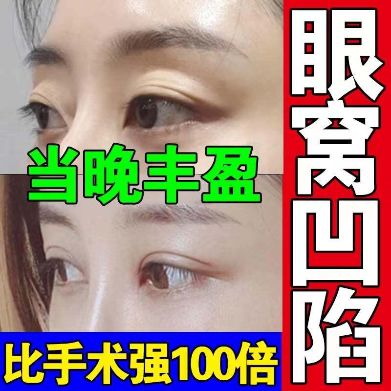 眼窝凹陷修复填充眼贴丰泪沟改善眼皮松弛眼眶提拉紧致神器