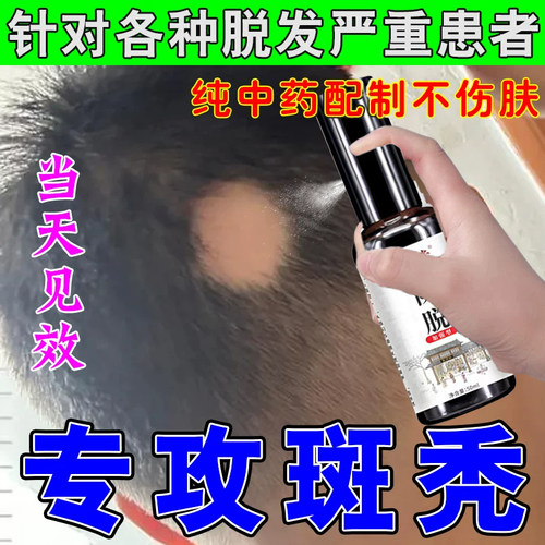 生发胶囊海外维生素b6防脱发健美生b族b7生物素养护头发