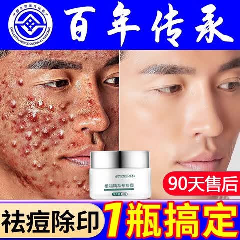 祛痘痘印痘坑修复膏凝露