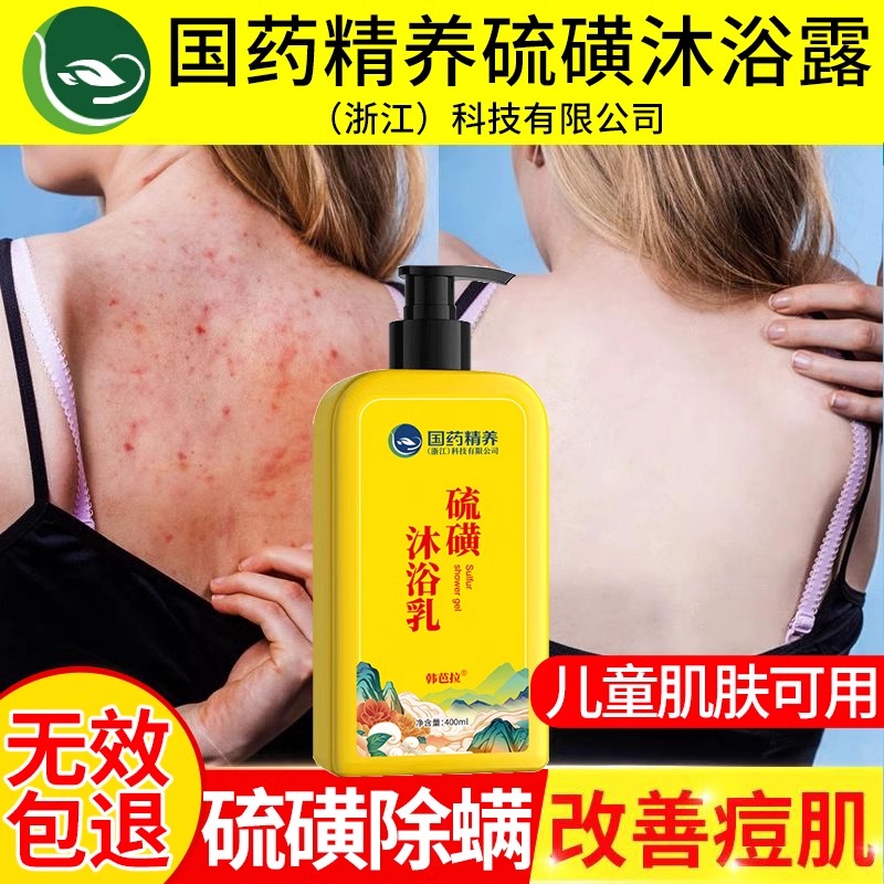 硫磺除螨沐浴露液皮肤瘙痒止痒抑菌上海正品官方香皂儿童净