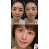 勿拍 Ⅲ型胶原蛋白肽反馈 安琪粉丝专享