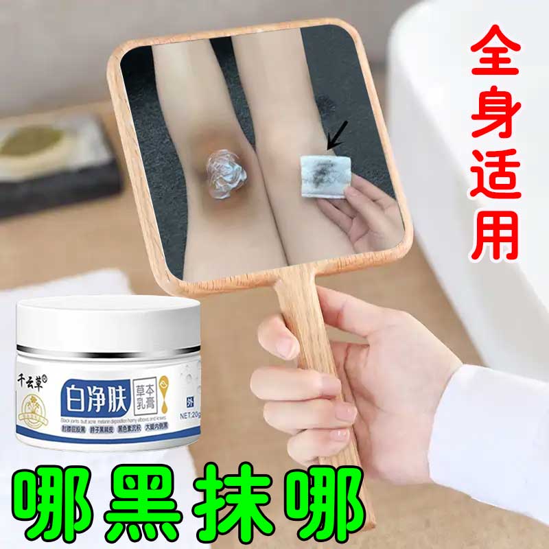 膝盖黑色素沉淀去除褪黑袪关节黑久坐屁股黑印脖子黑全身适用乳膏