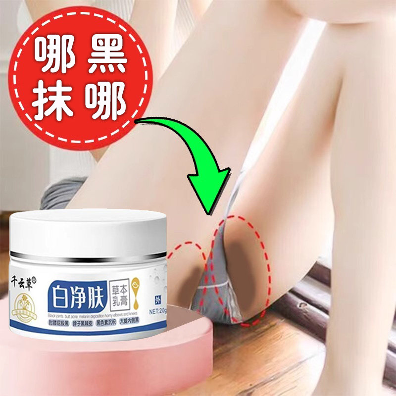 大腿内侧黑色素沉淀去除白净肤膏