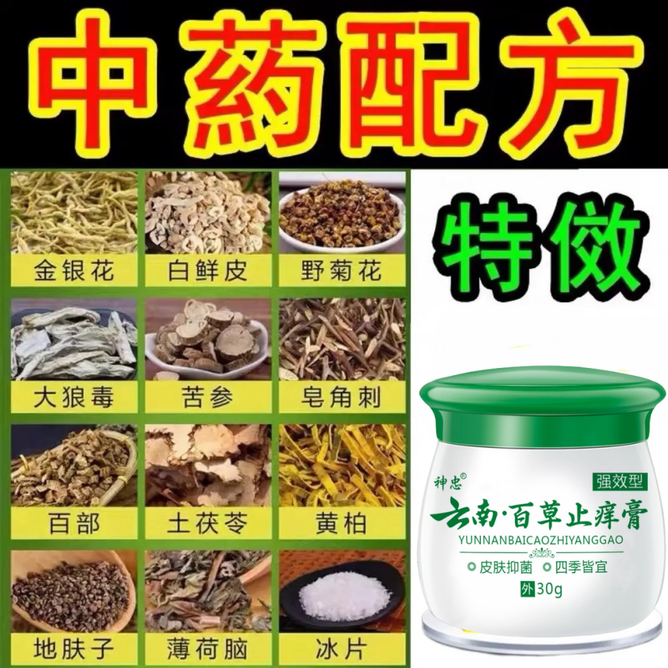 牛皮癣银屑病膏皮肤痒湿疹根去止保健理疗