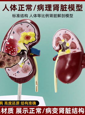 人体肾脏器官结构解剖模型