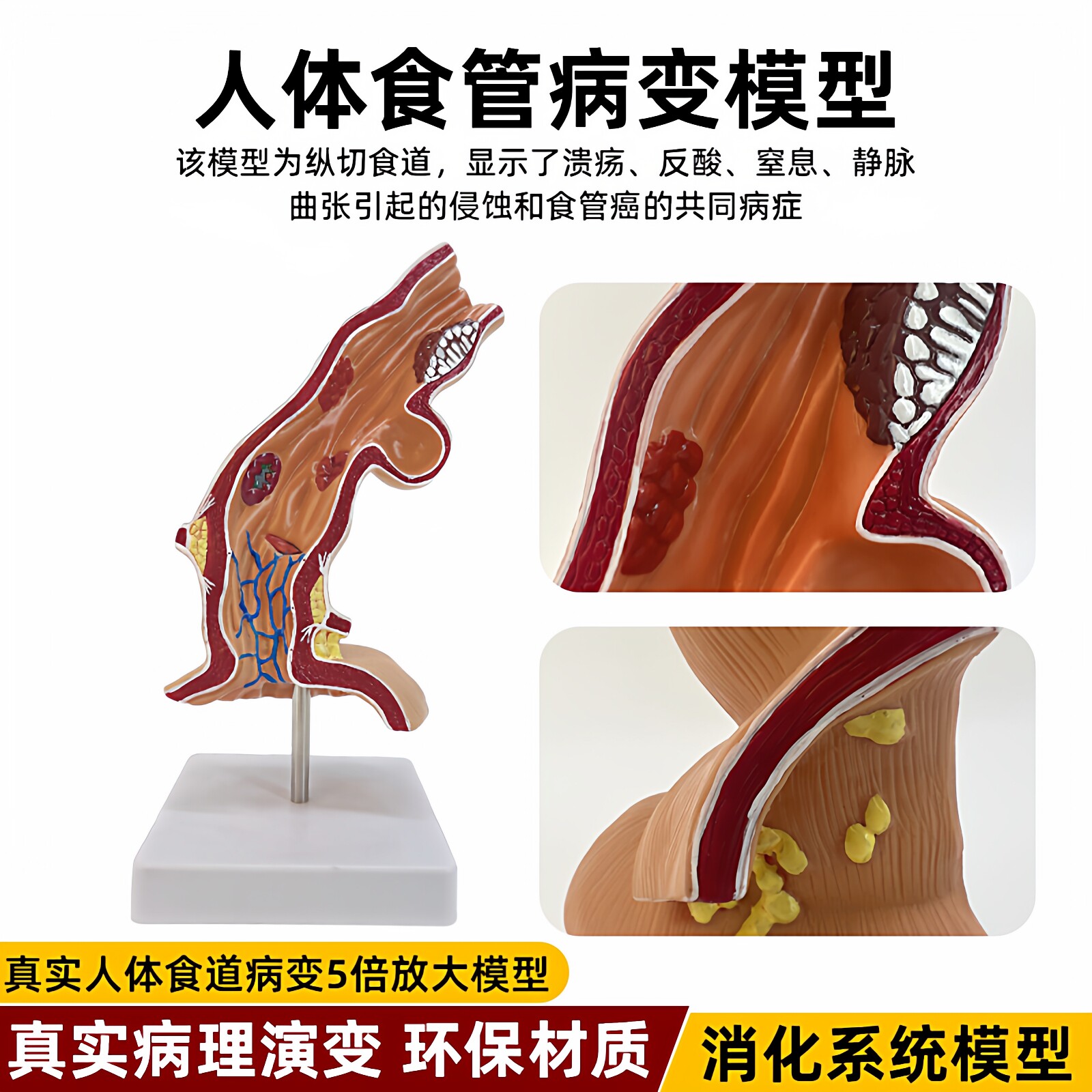 人体食管胃部消化系统模型