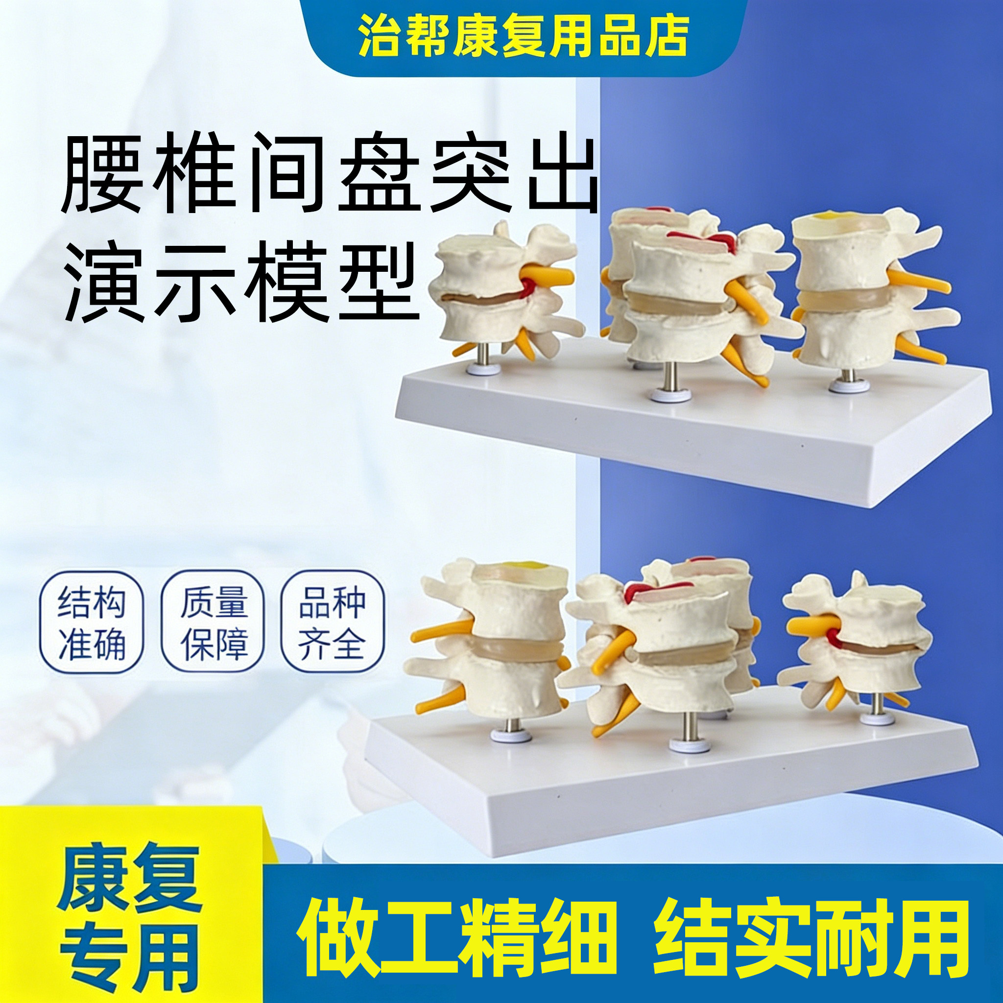 腰椎放腰椎间盘演示突出模型