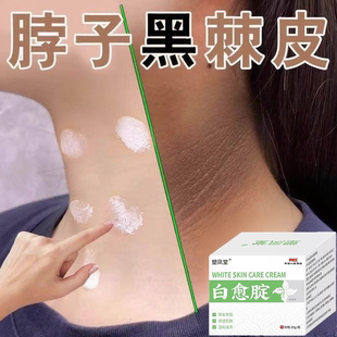 黑棘皮癥去除脖子黑色素沉淀淡化黑棘皮洗不干凈去黑脖子變白神器