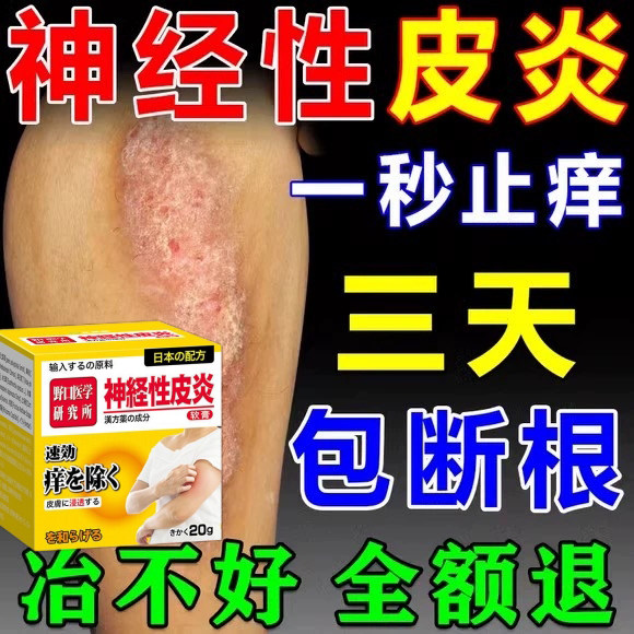 日本进口神经性皮炎专用特效药膏顽固牛皮癣断 根皮肤止瘙痒湿疹