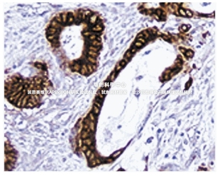 Pharmingen™ DAB底物试剂盒 DAB Kit 货号550880 Substrate