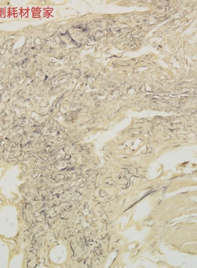 Verhöeff弹力纤维染色试剂盒2*100ml显示粗大纤维 适用切片染色