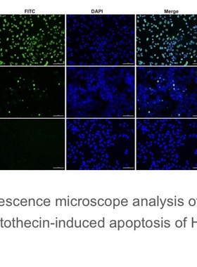 Elabscience®一步法TUNEL原位细胞凋亡检测试剂盒（绿色，FITC）