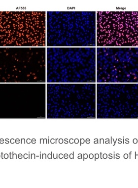 Elabscience®一步法TUNEL原位细胞凋亡检测试剂盒（红色 AF555）