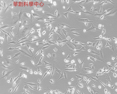 小鼠胚胎瘤细胞(ATDC5)培养基套装（种属鉴定正确）成纤维细胞样