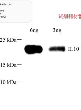 Anti-IL-10 Rabbit pAb,抗IL-6兔pAb,Il-10兔polyclonal antibody