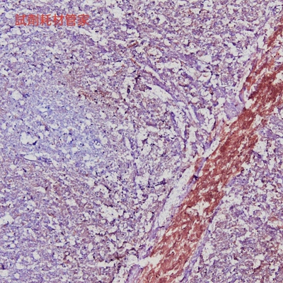 乙酰胆碱酯酶染色试剂盒(亚铁氰化铜法)Karnovsky-Roots法 2*20ml