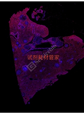 RNASweAMI™ 原位杂交CY3检测试剂盒 碱基互补配对与靶标RNA杂交