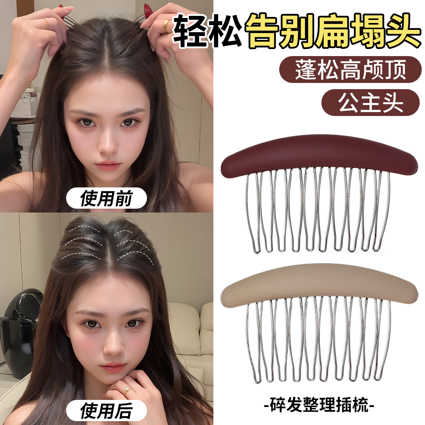 短发过渡期神器发梳插梳尴尬期发夹边夹侧边刘海发卡女公主头头饰