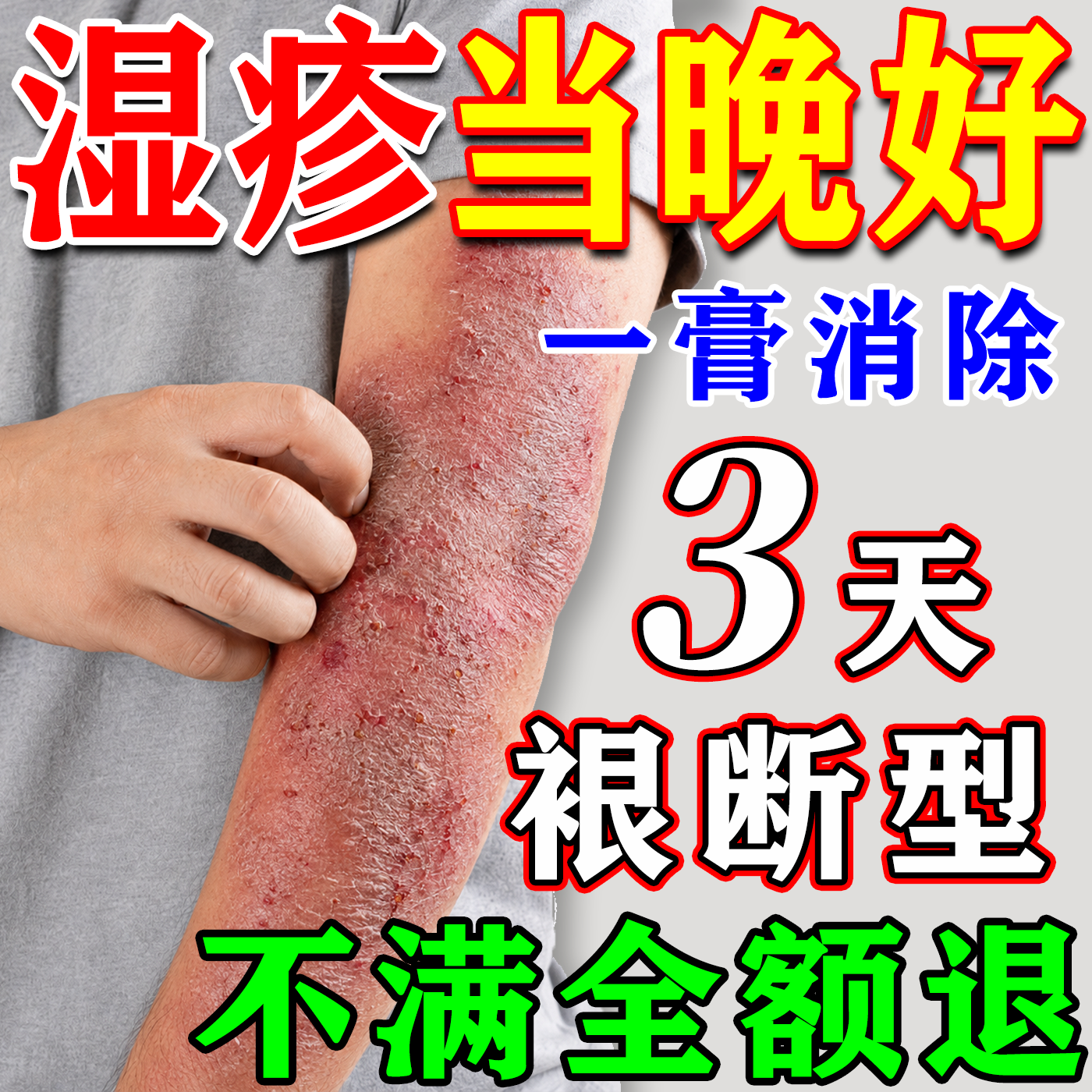 日本进口湿i疹膏[100%冶好]