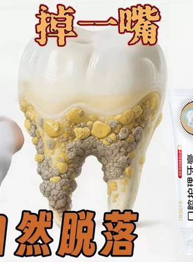 【抖音爆款】牙石溶解口腔修复牙膏洗牙齿污垢牙垢牙黄牙渍清理