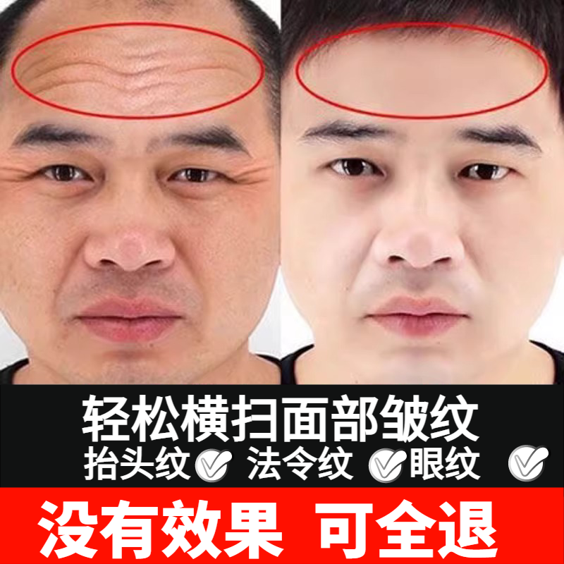 祛除皱纹神器男士抬头纹眼纹去除紧致六胜肽抗皱面霜嫩肤抗初衰老