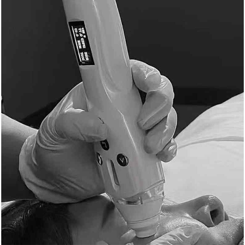 智能9d电动魔笔抚纹笔小蛮腰nk纹饰浅导仪卡式瓶耗材量子填充仪器