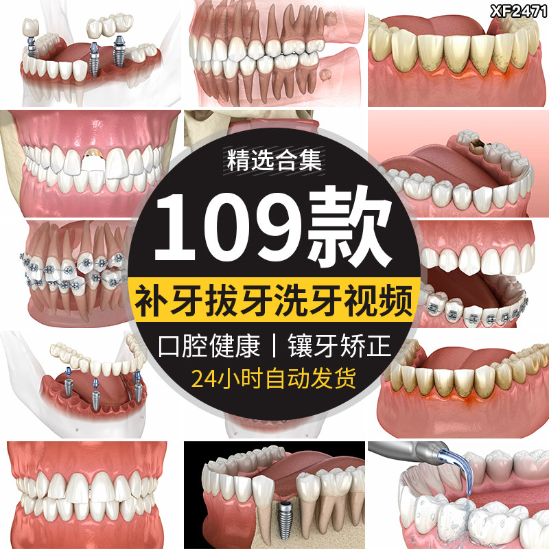 口腔卫生镶假牙拔牙齿矫正种植清洗牙科补牙医疗健康动画视频素材