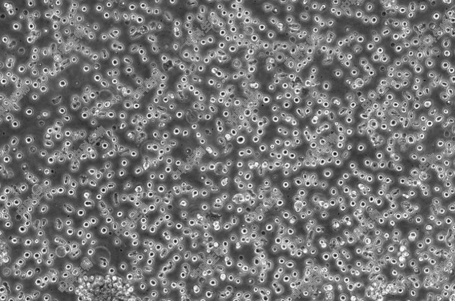 人B淋巴母细胞(HMY2.CIR)用作I型主要组织相容性抗原基因转染宿主