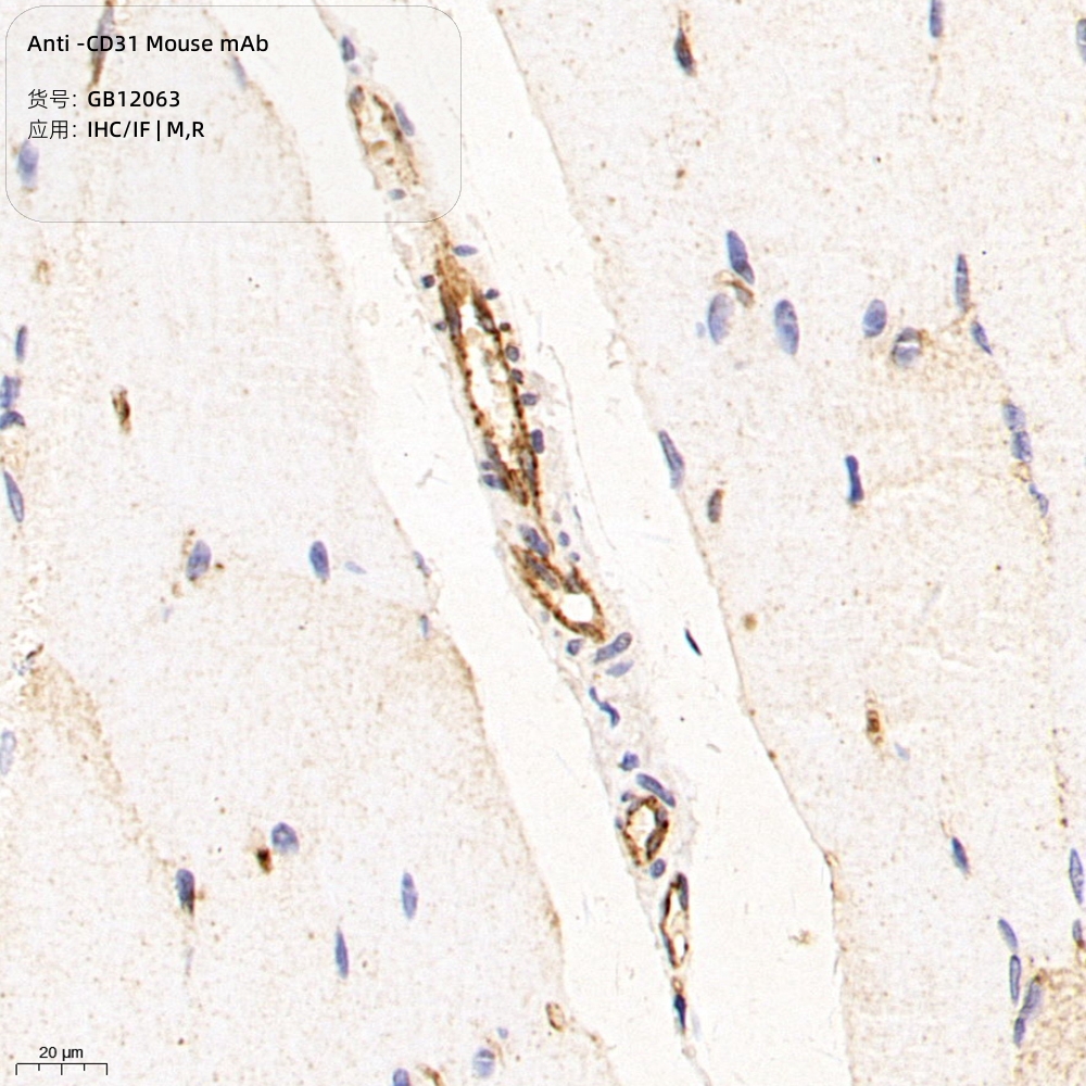 Servicebio抗-CD31小鼠单克隆抗体,适用IHC/IF,应用种属M/R标志物
